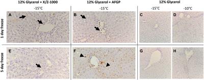 The role of antifreeze glycoprotein (AFGP) and polyvinyl alcohol/polyglycerol (X/Z-1000) as ice modulators during partial freezing of rat livers